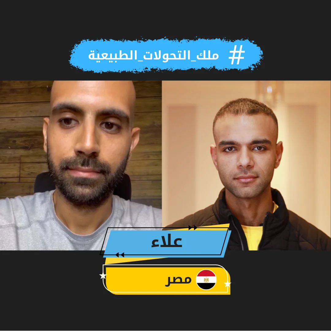 alaa