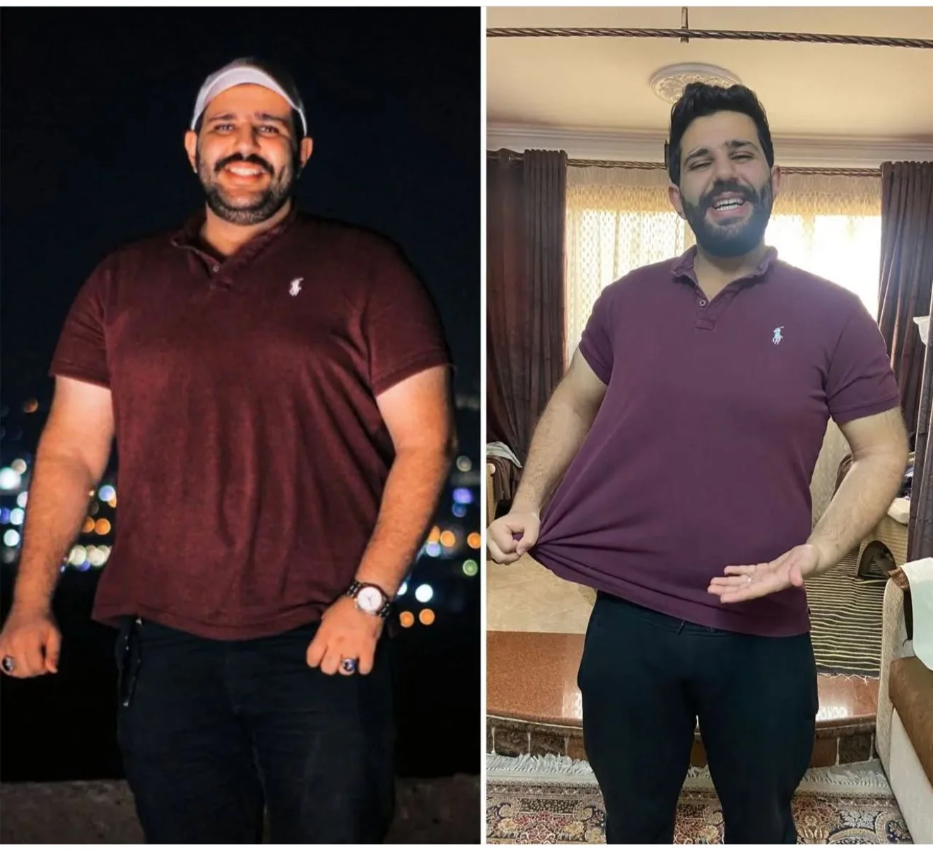بديل التكميم