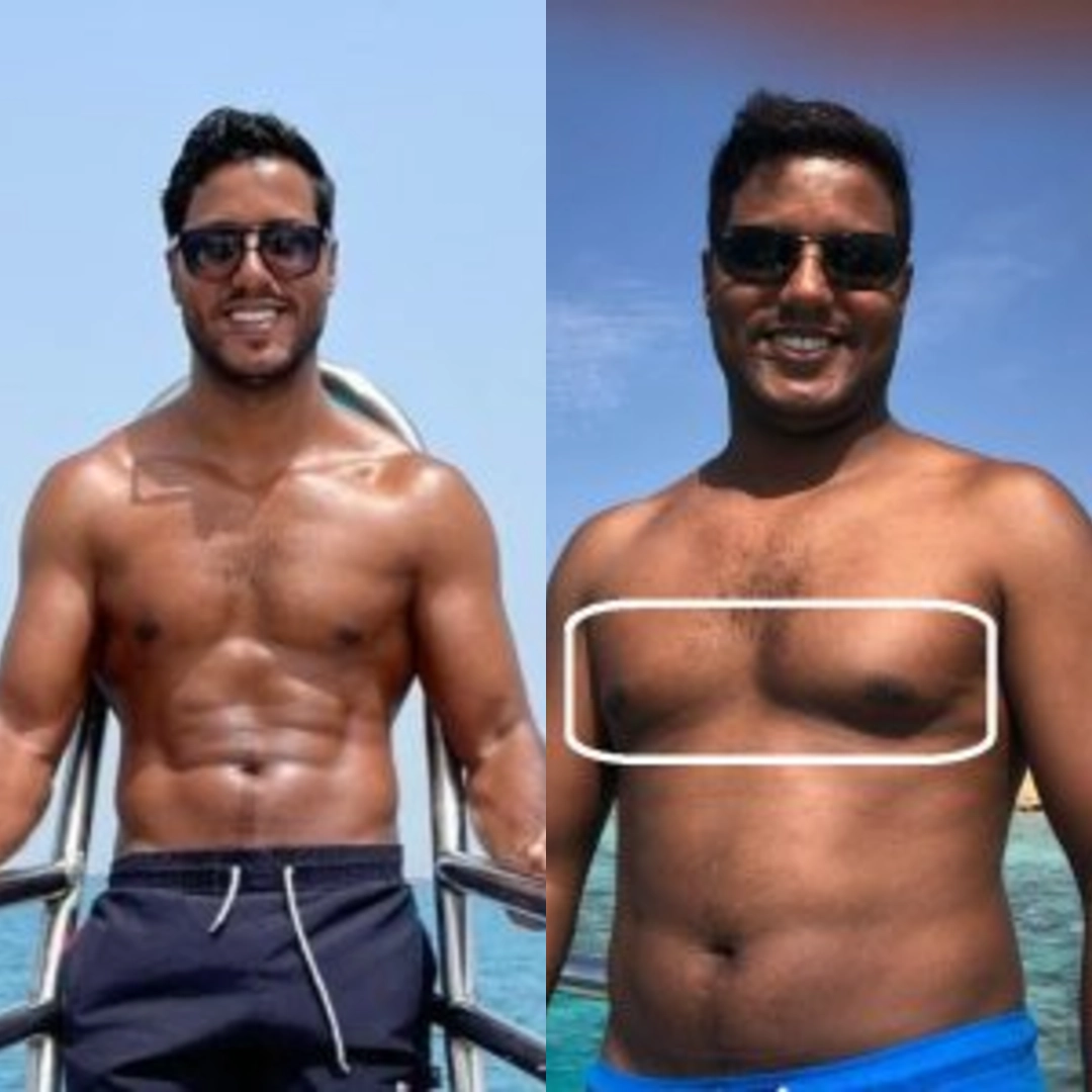 نتائج التثدي