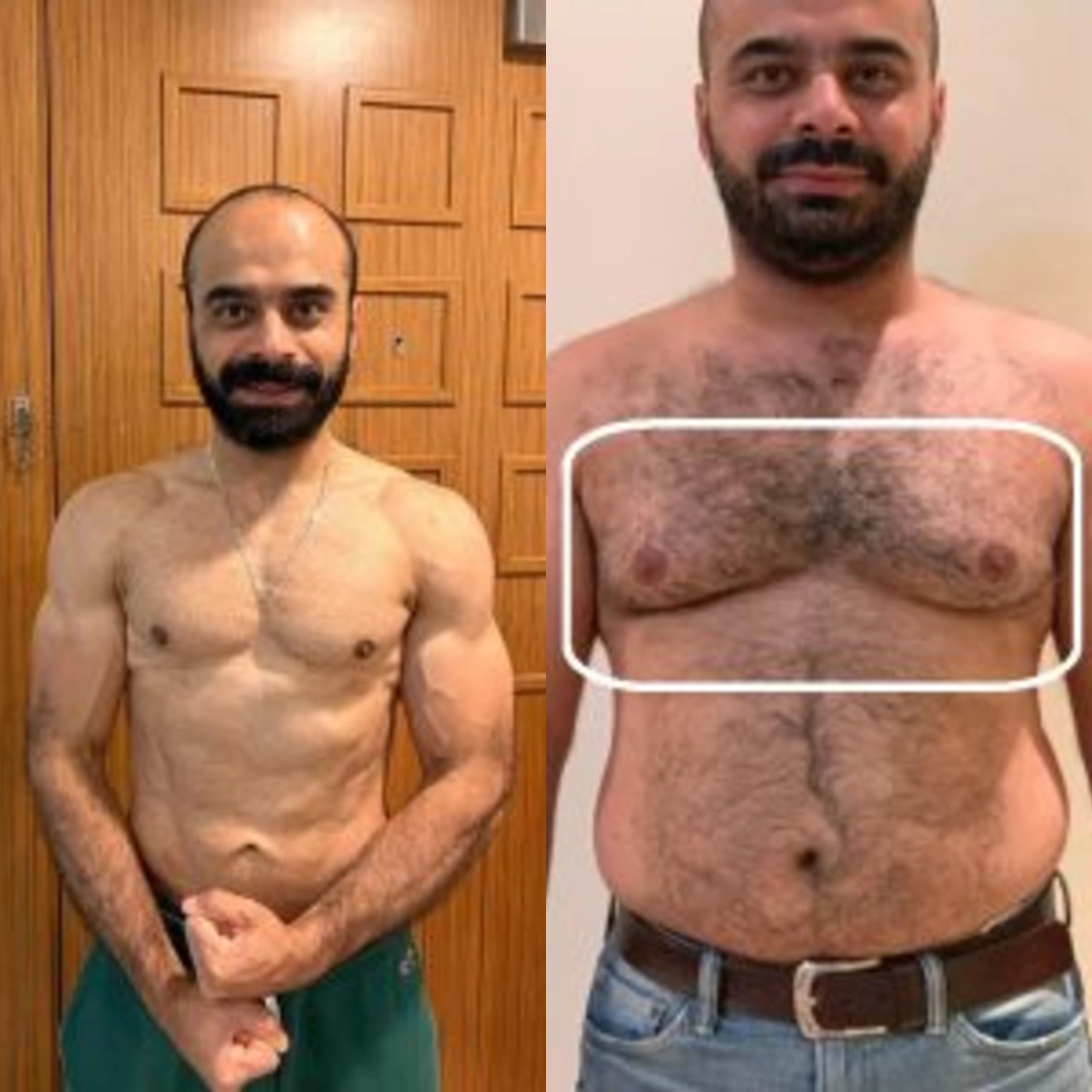 نتائج التثدي